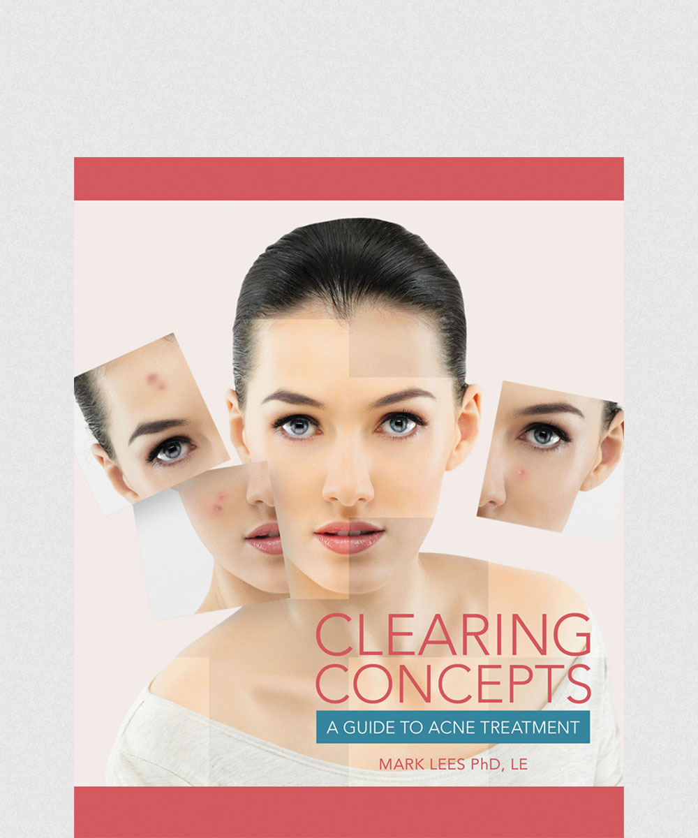 Clearing Concepts:A Guide to Acne Treatment