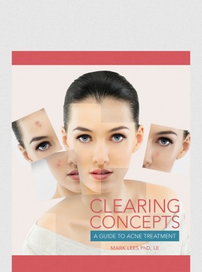 Clearing Concepts:A Guide to Acne Treatment